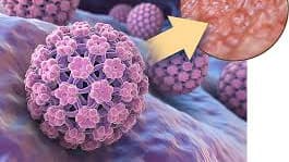hpv.jpg